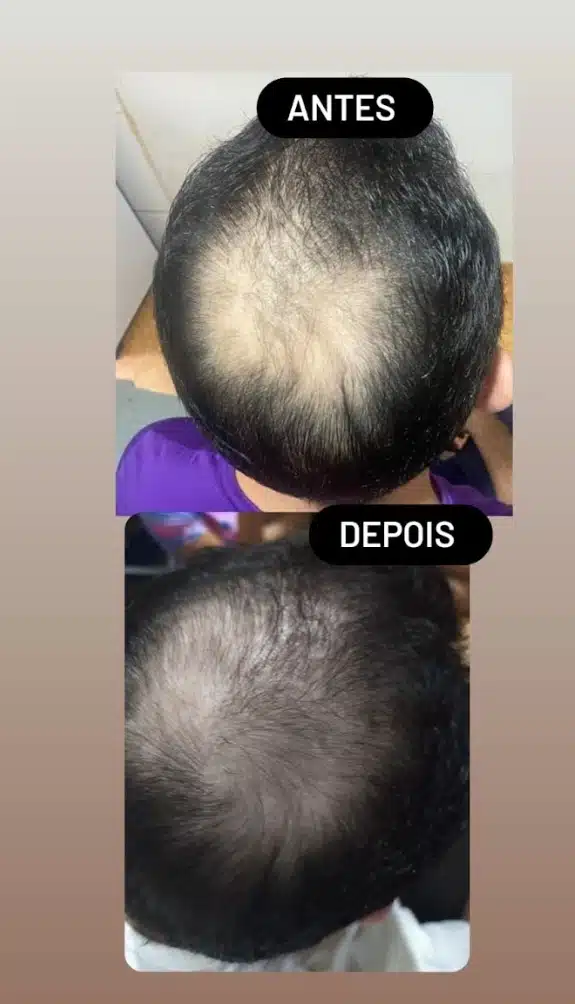 Feedback